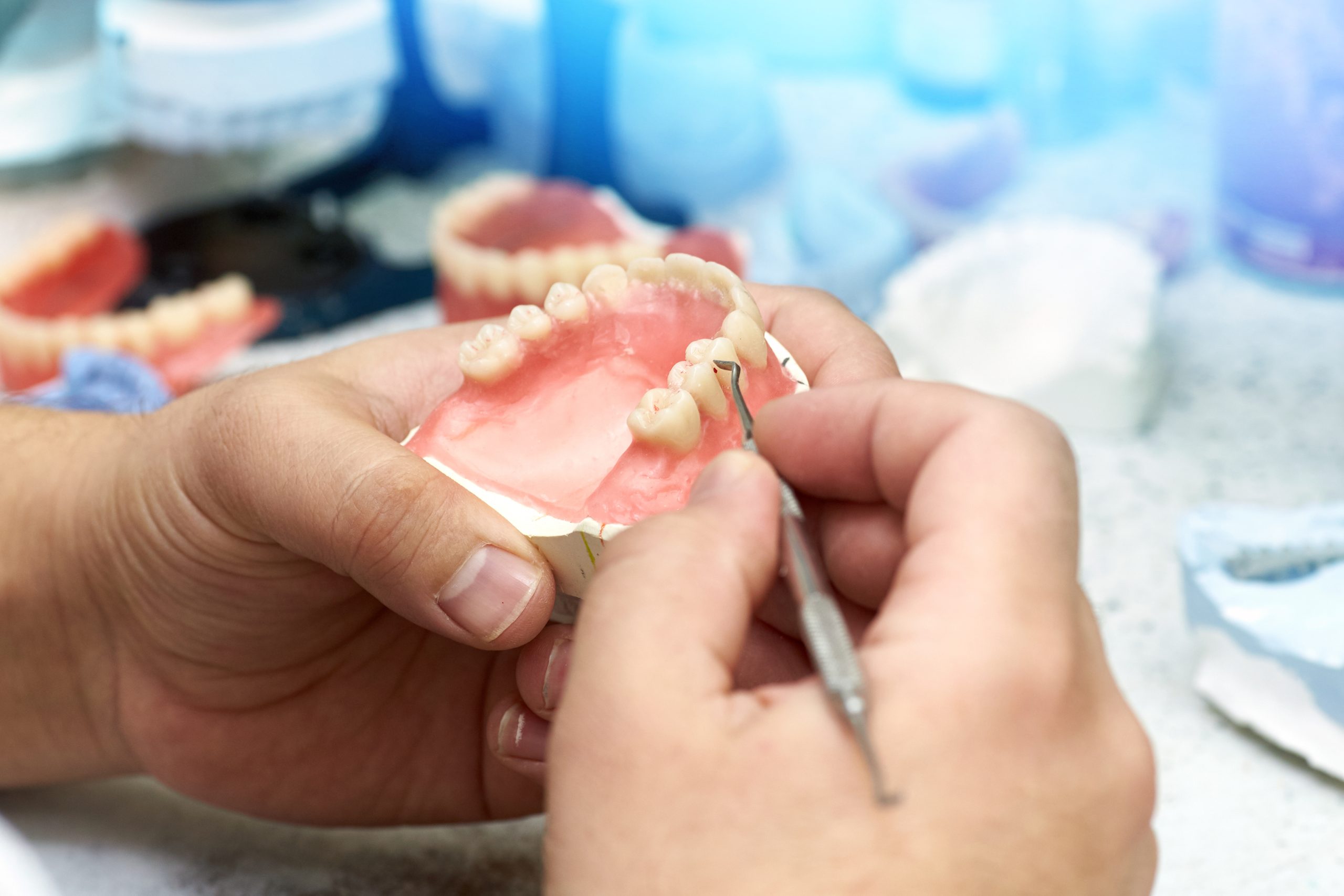 Dentist,Makes,A,Dental,Implant,Prosthesis,Made,Of,Plaster,Cast.