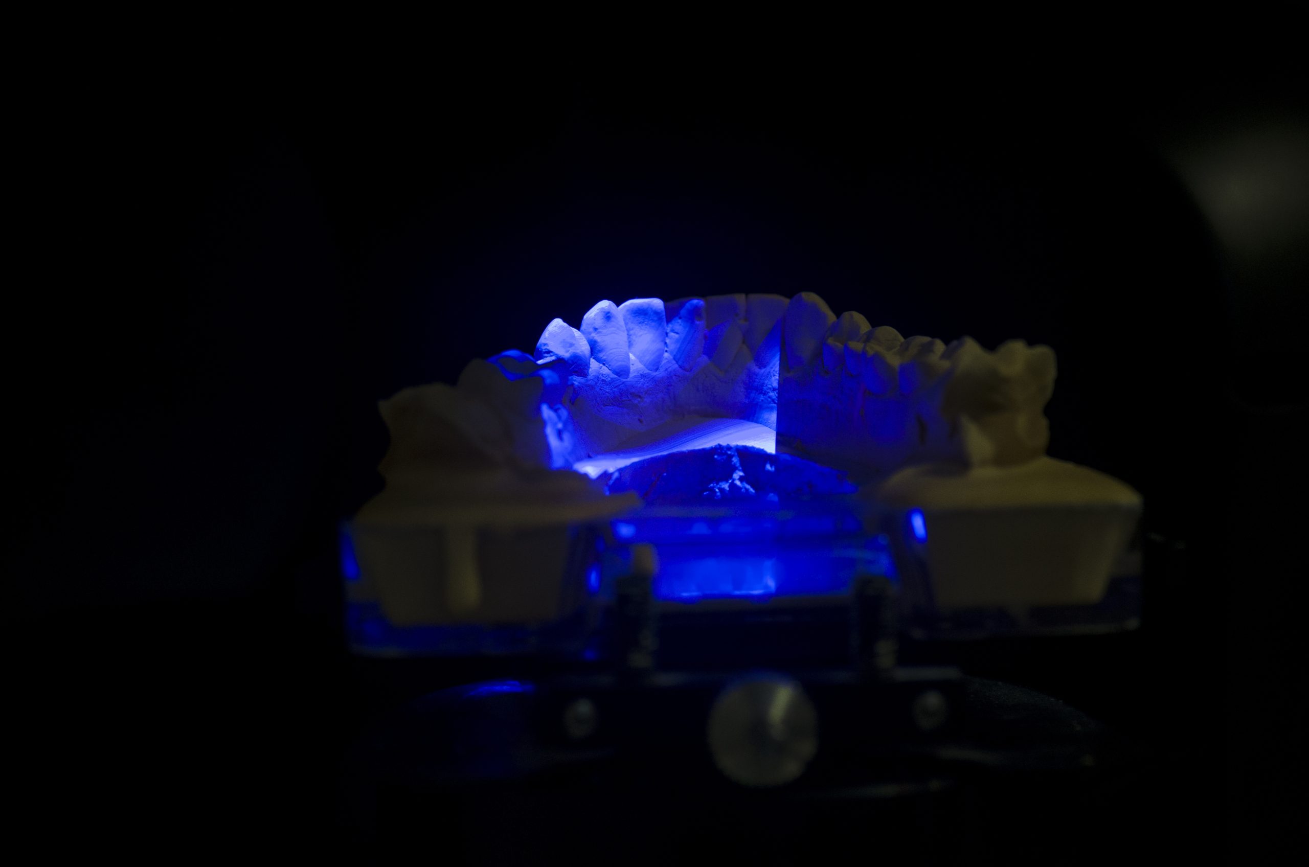 ESSE-EFFE-DENTAL-LINE-Laboratorio-Odontotecnico-Sbuttoni-Fausto-castelsangiovanni-protesi-mobile-protesi-fissa-zirconio-co-cr-disilicato-laser-melting-fresaggio-cad-cam-scheletrati-bite ESSE-EFFE-DENTAL-LINE-Laboratorio-Odontotecnico-Sbuttoni-Fausto-castelsangiovanni-protesi-mobile-protesi-fissa-zirconio-co-cr-disilicato-laser-melting-fresaggio-cad-cam-scheletrati-bite